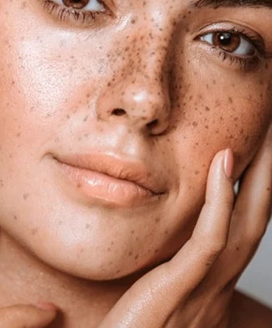 Why do I have dark spots on my skin?