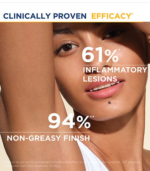 Photoderm AKN Mat - SPF 30 Anti Blemish Sunscreen For Combination To Acne-Prone Skin